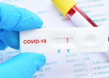 Ja ku mund ta kryeni testimin e shpejtë covid-19