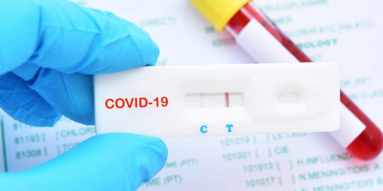 Ja ku mund ta kryeni testimin e shpejtë covid-19