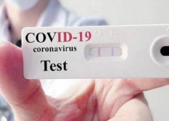 Covid-19: nis falas testimi i shpejt në Tiranë