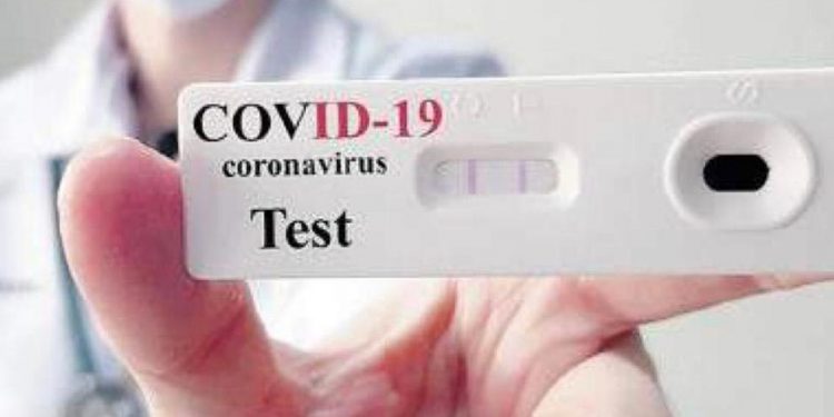 Covid-19: nis falas testimi i shpejt në Tiranë