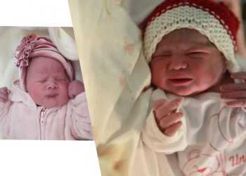 2021-shi çelet me goca. Vijnë në jetë Ajla dhe Meri (foto)