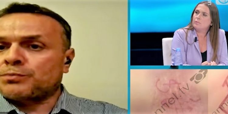 Krimet okulte në Tiranë, Karamuço: “Të sensibilizohen prindërit për ndryshimet tek fëmijët e tyre. Ata s’e dinë që do humbasin jetën, por fundi është i hidhur”