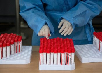 Zbulohet Xe, variant i ri i Covid-19. Shartim i Omicron-it me variantet BA1 dhe BA2