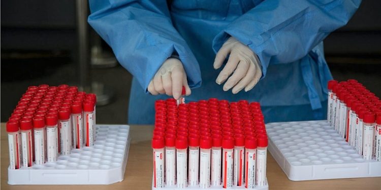 Zbulohet Xe, variant i ri i Covid-19. Shartim i Omicron-it me variantet BA1 dhe BA2