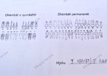 Vdekja e 3-vjeçarit, prokuroria nis hetimet/ Dentisti i kishte mbushur 14 dhëmbë njëherëshi