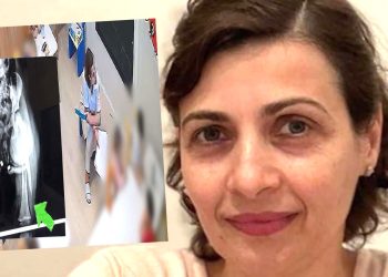 Deklarata e paprecedentë e edukatores që i theu këmbën  3 vjeçares: “I rashë me vizore që të kishte mendjen”