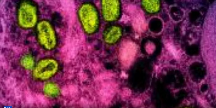 OBSH alarm për linë e majmunit/ Situatë emergjente