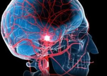 Studimi/ Rriten me 70% goditjet në tru. Fajtorë smogu, mbipesha dhe duhani