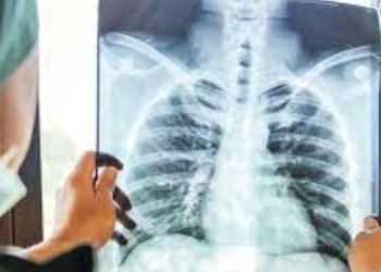 67 raste turbekolozi në Kansas të SHBA.  Situata e parë që pas 1950s