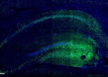 “Zgjimi” i kromozomit X: Zbulohet arsyeja pse femrat plaken më ngadalë se meshkujt