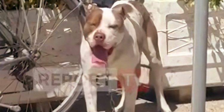 E kafshon pitbulli në kokë, fati i 4-vjeçares që shpëtohet nga një punëtor që ndodhej aty pranë